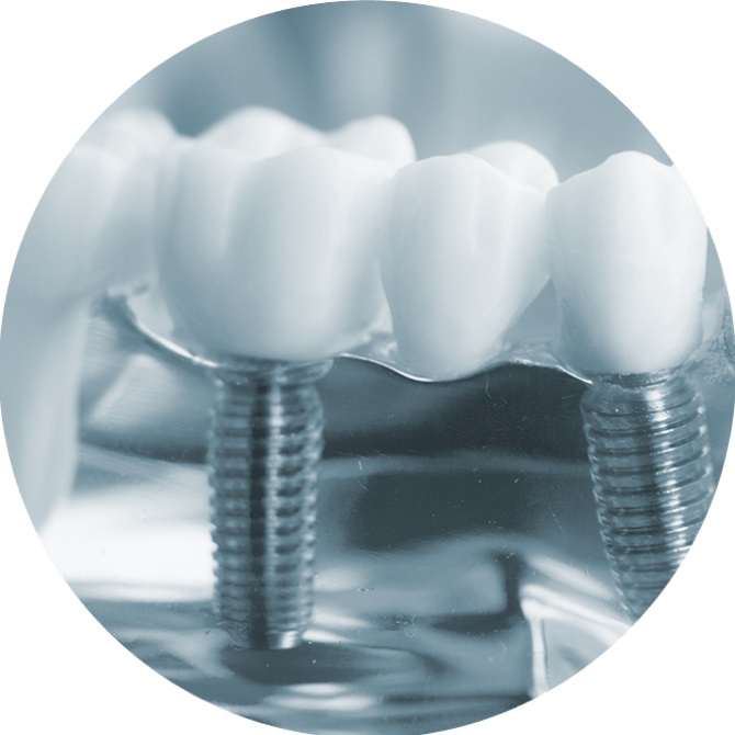 implantdental
